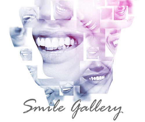 Manhattan Dental Care Studio Smile Gallery
