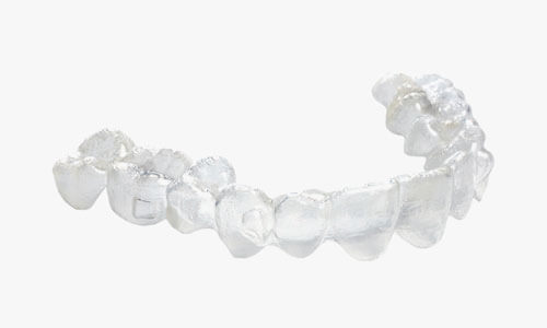 Invisalign Procedure 2 Weeks