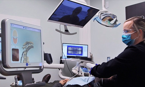 Invisalign Procedure Scan