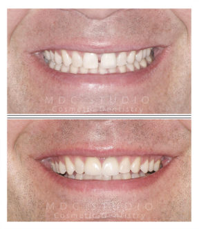 Manhattan Dental Smile Gallery 18