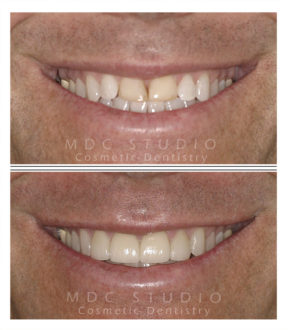 Manhattan Dental Smile Gallery 23