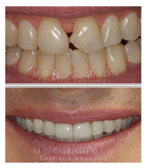 Manhattan Dental Smile Gallery 27