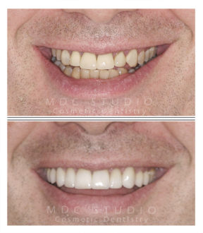 Manhattan Dental Smile Gallery 30