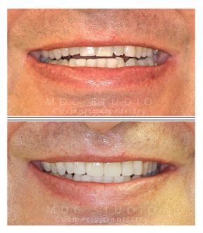 Manhattan Dental Smile Gallery 36