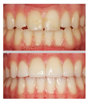 Manhattan Dental Smile Gallery 37