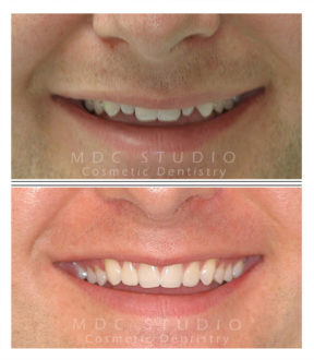 Manhattan Dental Smile Gallery 4