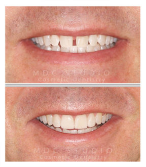 Manhattan Dental Smile Gallery 41