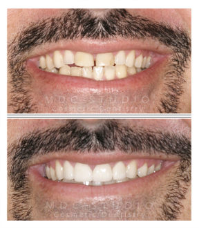 Manhattan Dental Smile Gallery 43