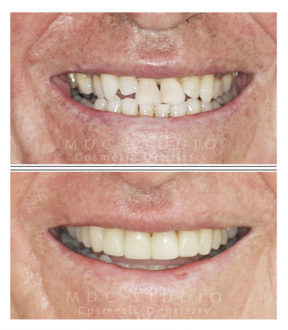 Manhattan Dental Smile Gallery 47