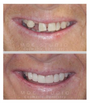 Manhattan Dental Smile Gallery 49