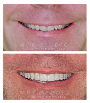 Manhattan Dental Smile Gallery 9