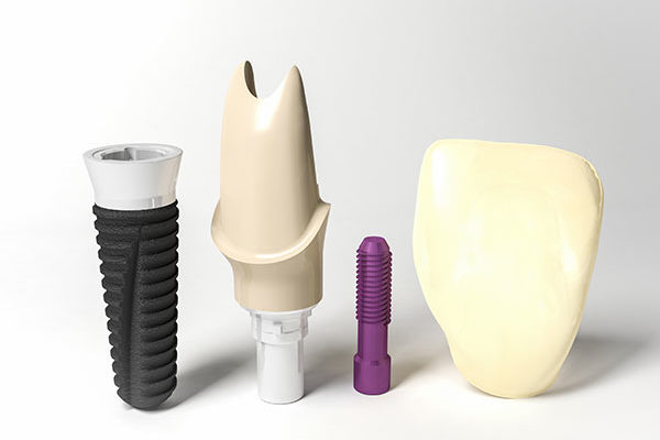 Dental Implants Front Tooth Implant 2