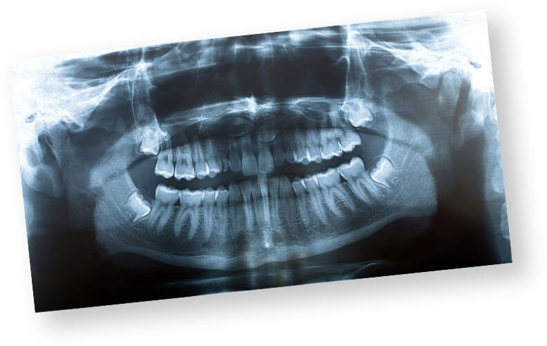 Tech Dental X-Ray