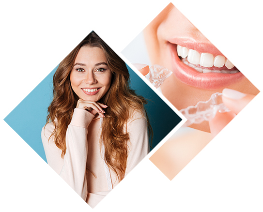 5 Reasons to Consider Invisalign Over Braces
