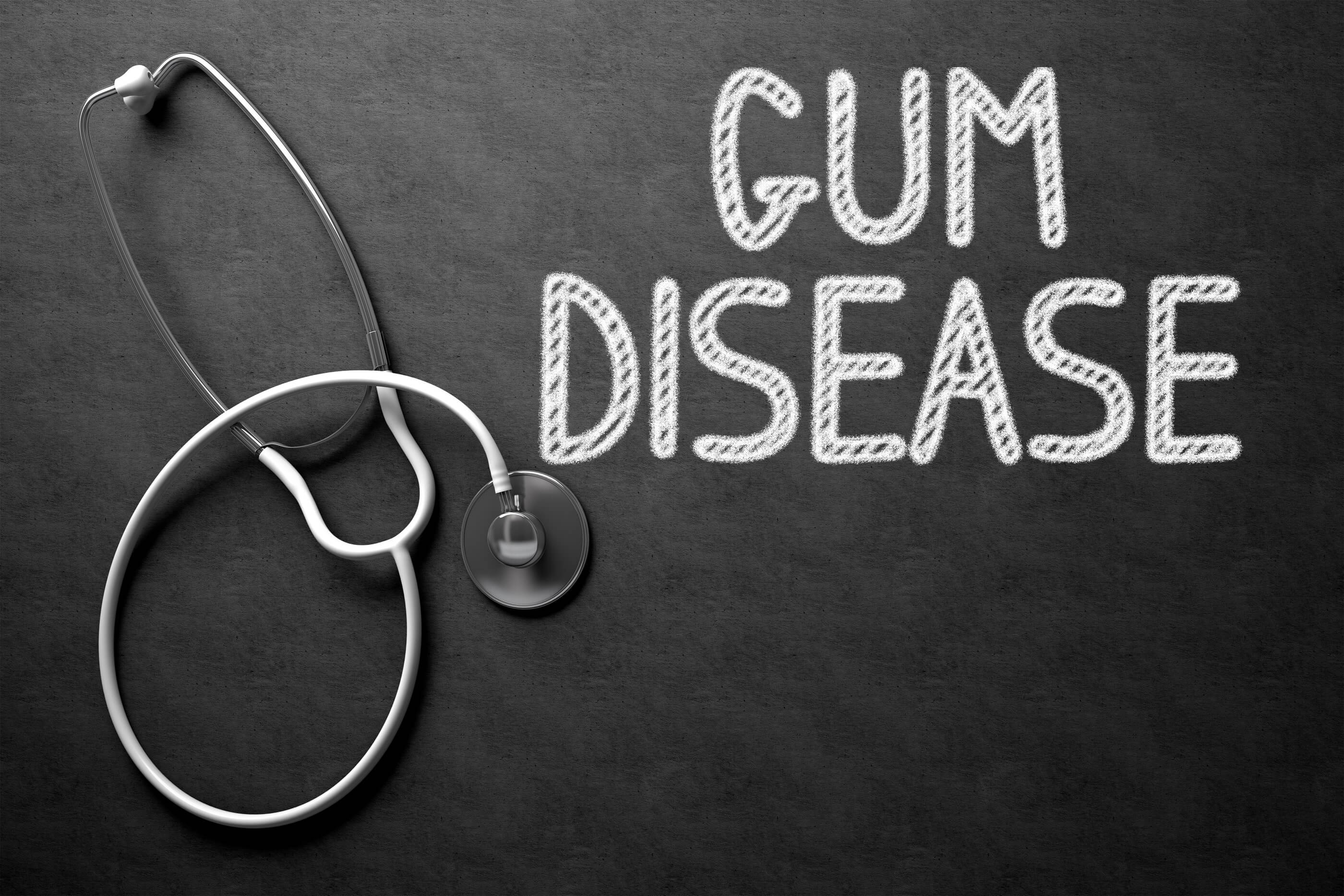 Gum Disease and Gingivitis